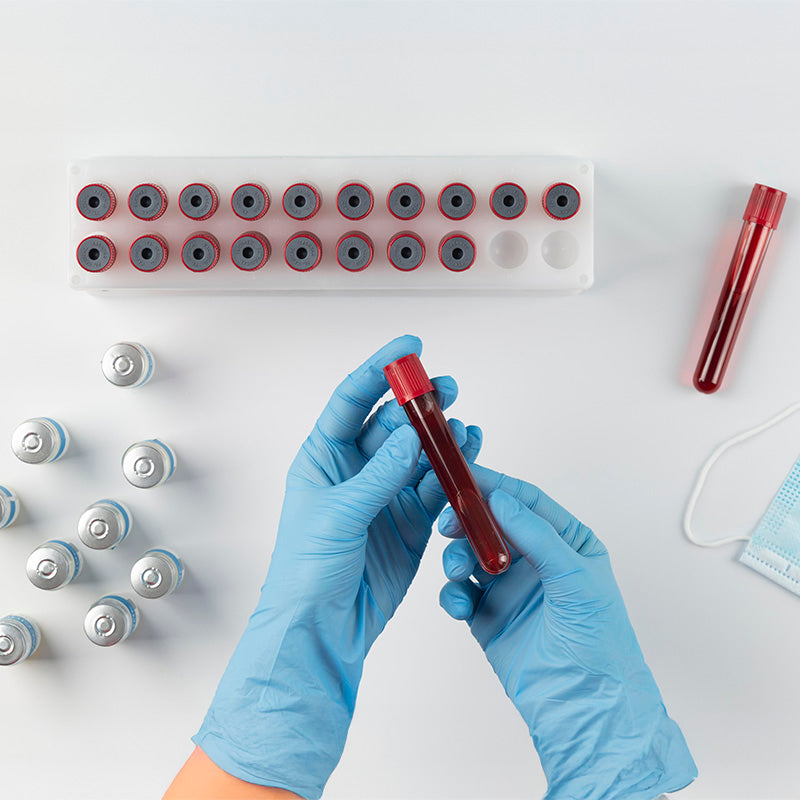 Complete Blood Picture (CBP) Test