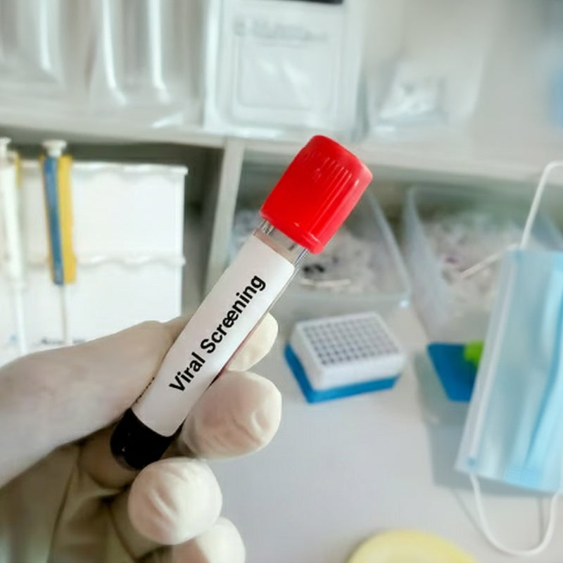 Viral Screening
